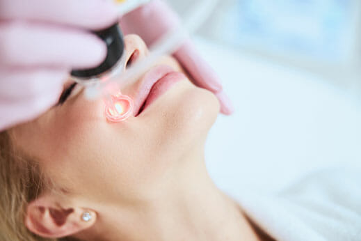 Laser Therapies Skin Rejuvenation 4