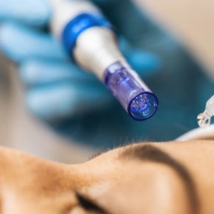 Dermal Needling Diploma Of Salon Management And Beauty Therapy